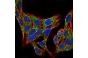 Immunocytochemistry (ICC) image for anti-Phosphoinositide 3 Kinase, p85 alpha (PI3K p85a) (AA 159-388) antibody (ABIN1844692)