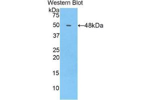 Western Blotting (WB) image for anti-Collagen, Type XIV, alpha 1 (COL14A1) (AA 1280-1461) antibody (ABIN1858447) (COL14A1 抗体  (AA 1280-1461))