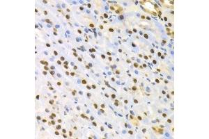 Immunohistochemistry of paraffin-embedded rat kidney using SFN Antibody. (14-3-3 sigma/SFN 抗体  (AA 1-248))