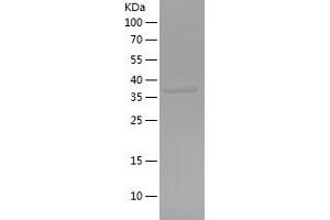 Western Blotting (WB) image for ATPase, Na+/K+ Transporting, beta 1 Polypeptide (ATP1B1) (AA 186-303) protein (His-IF2DI Tag) (ABIN7282153) (ATP1B1 Protein (AA 186-303) (His-IF2DI Tag))