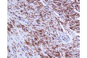 Formalin-fixed and paraffin embedded mouse heart tissue labeled Anti-Connexin-45 Polyclonal Antibody, Unconjugated  at 1:200, followed by conjugation to the secondary antibody and DAB staining (GJC1 抗体  (AA 81-130))