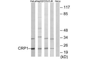 Western Blotting (WB) image for anti-Cysteine and Glycine-Rich Protein 1 (CSRP1) (Internal Region) antibody (ABIN1849240) (CSRP1 抗体  (Internal Region))