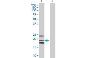 Western Blot analysis of PTGDS expression in transfected 293T cell line by PTGDS MaxPab polyclonal antibody. (PTGDS 抗体  (AA 1-190))
