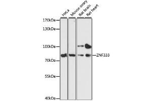 Western blot analysis of extracts of various cell lines, using ZNF333 antibody. (ZNF333 抗体  (AA 1-303))