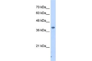 WB Suggested Anti-PIP3-E Antibody Titration:  2. (ICEF1 抗体  (C-Term))