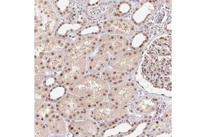 Immunohistochemical staining (Formalin-fixed paraffin-embedded sections) of human kidney with CAND1 polyclonal antibody  shows moderate cytoplasmic and nuclear positivity in renal tubules at 1:1000 - 1:2500 dilution. (CAND1 抗体)