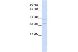 Image no. 1 for anti-Potassium Channel Regulator (KCNRG) (N-Term) antibody (ABIN6742716)
