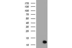 Image no. 1 for anti-Chromosome 17 Open Reading Frame 37 (C17orf37) antibody (ABIN1501775) (C17orf37 抗体)