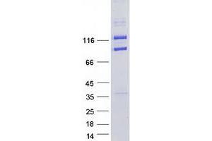 Western Blotting (WB) image for CAP-GLY Domain Containing Linker Protein 2 (CLIP2) (Transcript Variant 1) protein (Myc-DYKDDDDK Tag) (ABIN2712880)
