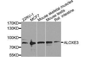 Western blot analysis of extracts of various cell lines, using ALOXE3 antibody. (ALOXE3 抗体  (AA 1-280))