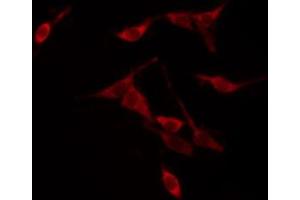 ABIN6267566 staining NIH-3T3 by IF/ICC. (14-3-3 zeta 抗体  (pThr232))