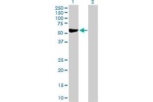 Western Blot analysis of ALDH3A1 expression in transfected 293T cell line by ALDH3A1 MaxPab polyclonal antibody. (ALDH3A1 抗体  (AA 1-453))