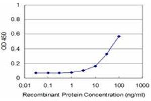Detection limit for recombinant GST tagged FHIT is approximately 3ng/ml as a capture antibody. (FHIT 抗体  (AA 31-130))