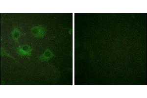 Immunofluorescence analysis of HuvEc cells, using Claudin 3 antibody. (Claudin 3 抗体)