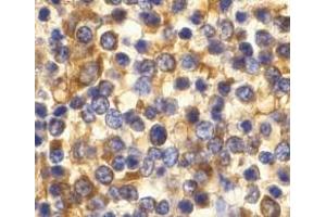 Immunohistochemistry of CCR3 in human spleen tissue with CCR3 antibody at 10 μg/ml. (CCR3 抗体  (C-Term))