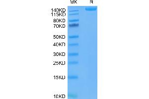 SDS-PAGE (SDS) image for SARS-CoV-2 Spike (D614G), (Trimer) protein (His-Avi Tag) (ABIN7274402)