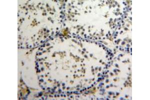 Immunohistochemistry (IHC) image for anti-Apoptosis Antagonizing Transcription Factor (AATF) (AA 240-438) antibody (ABIN2118159)