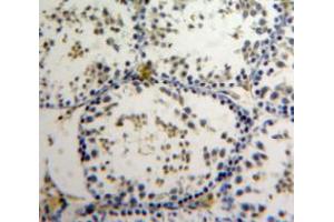 Used in DAB staining on fromalin fixed paraffin-embedded Testis tissue (AATF 抗体  (AA 240-438))