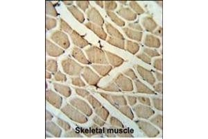 YTHD3 Antibody (Center) ABIN653943 IHC analysis in formalin fixed and paraffin embedded skeletal muscle followed by peroxidase conjugation of the secondary antibody and DAB staining. (YTHDF3 抗体  (AA 228-257))