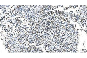 IHC analysis of DRP1/DNM1L using anti-DRP1/DNM1L antibody (ABIN7602180). (Dynamin 1-Like 抗体  (AA 618-736))