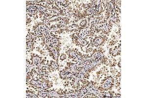 IHC analysis of SART1 using anti-SART1 antibody (ABIN7599884).