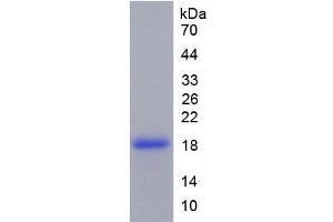 SDS-PAGE analysis of Rat Tenascin C Protein. (TNC 蛋白)