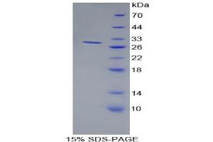SDS-PAGE analysis of Human BST1 Protein. (BST1 蛋白)