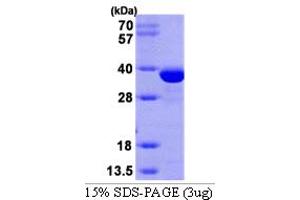 Sulfotransferase Family 1E Member 1 (SULT1E1) (AA 1-294) protein (His tag)