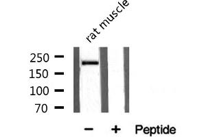 Western blot analysis on rat muscle tissue lysate using Sodium Channel-pan Antibody (Sodium Channel-Pan 抗体)