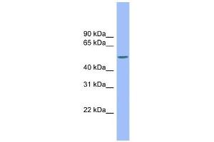 CSF1 antibody used at 1 ug/ml to detect target protein. (M-CSF/CSF1 抗体)