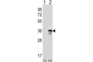 Western Blotting (WB) image for anti-U2 Small Nuclear RNA Auxiliary Factor 1 (U2AF1) antibody (ABIN3001639) (U2AF1 抗体)