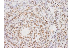Immunohistochemistry (IHC) image for anti-Proline-, Glutamic Acid- and Leucine-Rich Protein 1 (PELP1) (AA 1000-1050) antibody (ABIN7448722) (PELP1 抗体  (AA 1000-1050))