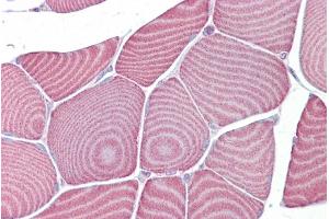 Immunohistochemistry with Skeletal muscle tissue at an antibody concentration of 5µg/ml using anti-FABP3 antibody (ARP47482_P050) (FABP3 抗体  (Middle Region))