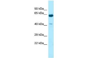 WB Suggested Anti-KRT9 Antibody Titration: 1. (KRT9 抗体  (C-Term))