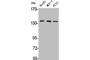 Western Blot analysis of HuvEc MCF7 PC12 cells using A Cyclase V/VI Polyclonal Antibody (ADCY6 抗体  (C-Term))