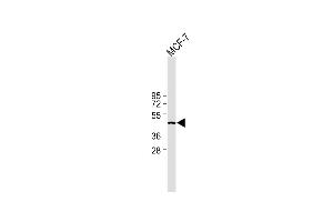 All lanes : Anti-IDH1 Antibody (Center) at 1:2000 dilution Lane 1: MCF-7 whole cell lysate Lysates/proteins at 20 μg per lane. (IDH1 抗体  (AA 116-143))