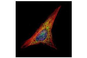 ICC/IF Image Confocal immunofluorescence analysis (Olympus FV10i) of methanol-fixed HeLa, using Gelsolin, antibody (Green) at 1:500 dilution. (Gelsolin 抗体  (C-Term))