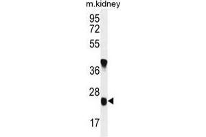 U119B Antibody (C-term) western blot analysis in mouse kidney tissue lysates (35 µg/lane). (UNC119B 抗体  (C-Term))