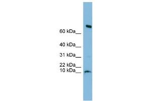 WB Suggested Anti-C1orf122 Antibody Titration: 0. (C1orf122 抗体  (N-Term))