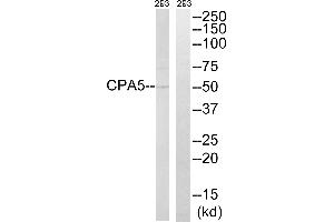 Western blot analysis of extracts from 293 cells, using CPA5 antibody. (CPA5 抗体)