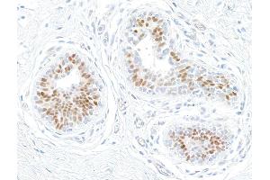 Immunohistochemistry (IHC) image for anti-Estrogen Receptor 1 (ESR1) antibody (ABIN7455134) (Estrogen Receptor alpha 抗体)