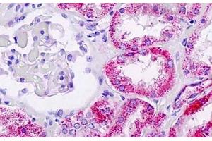 Human Kidney: Formalin-Fixed, Paraffin-Embedded (FFPE) (FUCA1 抗体  (AA 265-294))