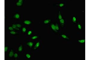 Immunofluorescent analysis of Hela cells using ABIN7150201 at dilution of 1:100 and Alexa Fluor 488-congugated AffiniPure Goat Anti-Rabbit IgG(H+L) (MLH1 抗体  (AA 350-519))