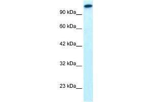 Western Blotting (WB) image for anti-GLI Family Zinc Finger 2 (GLI2) (Middle Region) antibody (ABIN2777474)