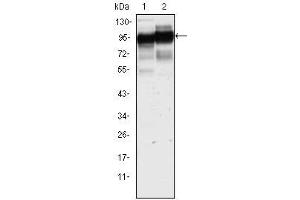 Western Blot showing using CD44 antibody used against Hela (1) and HUVE-12 (2) cell lysate. (CD44 抗体)