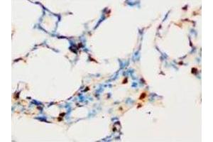 Immunohistochemical analysis of paraffin-embedded rat tissue sections (lung), staining SOCS1 in nucleus, DAB chromogenic reaction (SOCS1 抗体  (C-Term))