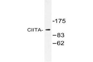 Western blot (WB) analysis of CIITA antibody in extracts from K562 cells. (CIITA 抗体)