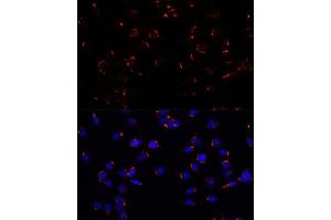 Immunofluorescence analysis of C6 cells using GOLG antibody (ABIN7267496) at dilution of 1:100. (GOLGA5 抗体  (AA 1-300))