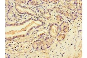 Immunohistochemistry of paraffin-embedded human pancreatic tissue using ABIN7168622 at dilution of 1:100 (SLFN11 抗体  (AA 670-821))