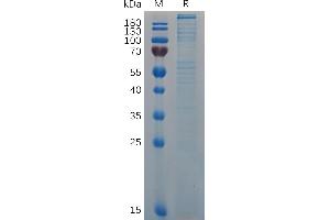 SDS-PAGE (SDS) image for Von Willebrand Factor (VWF) (AA 23-2813) protein (His tag) (ABIN7092871)